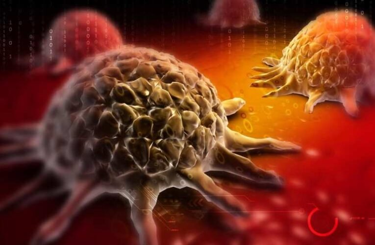 Az orvosok megdöbbenésére: természetes orvosság van a rákra (recept)