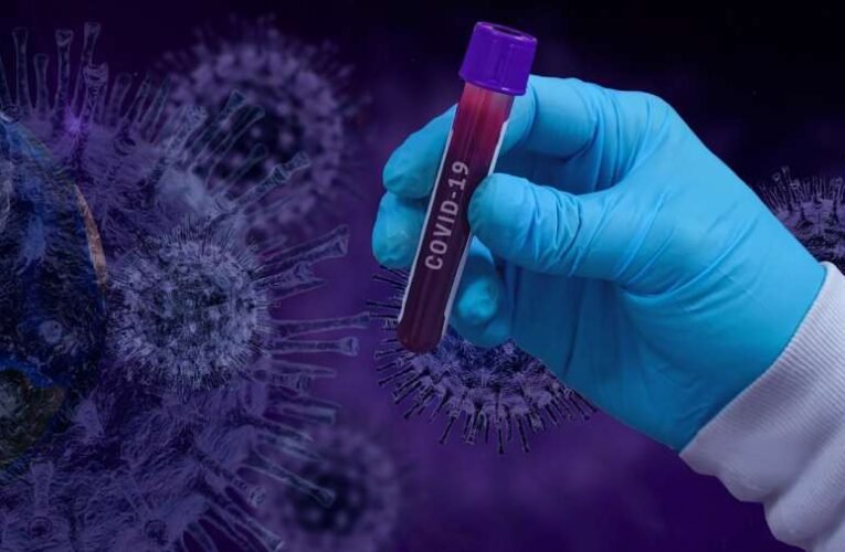 581 fővel emelkedett a beazonosított fertőzöttek száma és elhunyt nyolc krónikus beteg