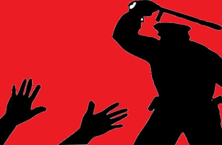 Akkor most elmondom mi a diktatúra…  (az SZFE töketlenjeinek)