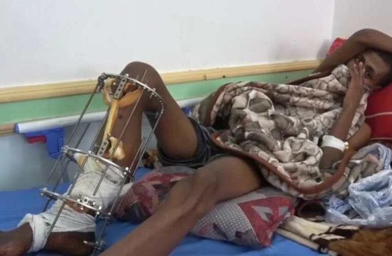 Több száz migránst lőhettek le Szaúd-Arábia határánál