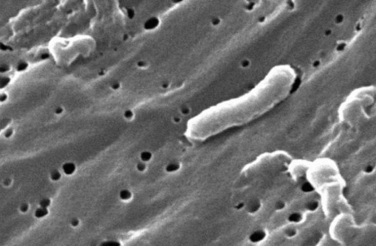 Meghalt az a fiatal édesapa, akit húsevő baktérium támadott meg