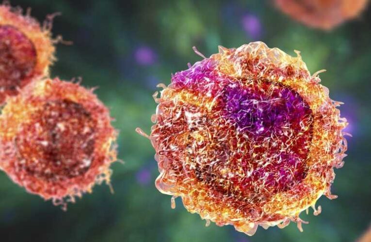 Szenzációs felfedezés: megtalálhatták a rák ellenszerét