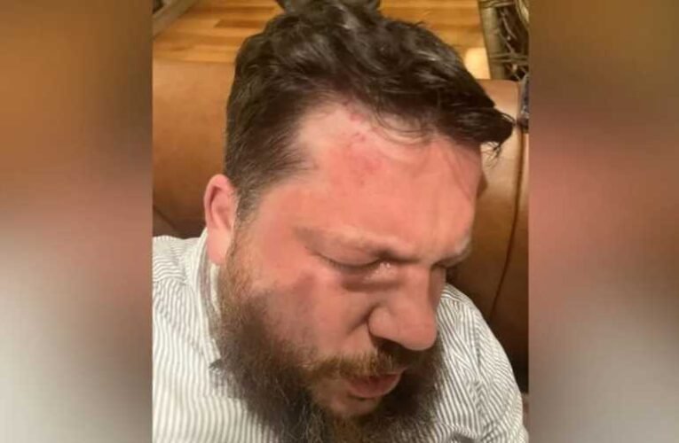 Alekszej Navalnij emberét kalapáccsal verték össze Litvániában