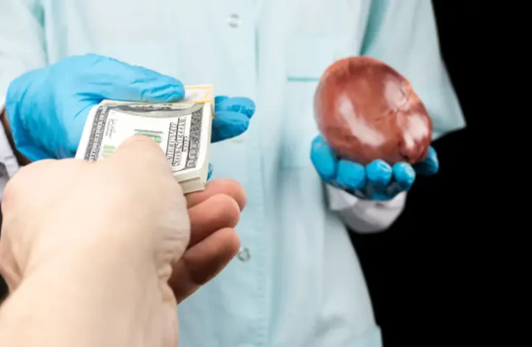 Emberiszerv-kereskedelem Ukrajnában idegen zsoldosok közreműködésével