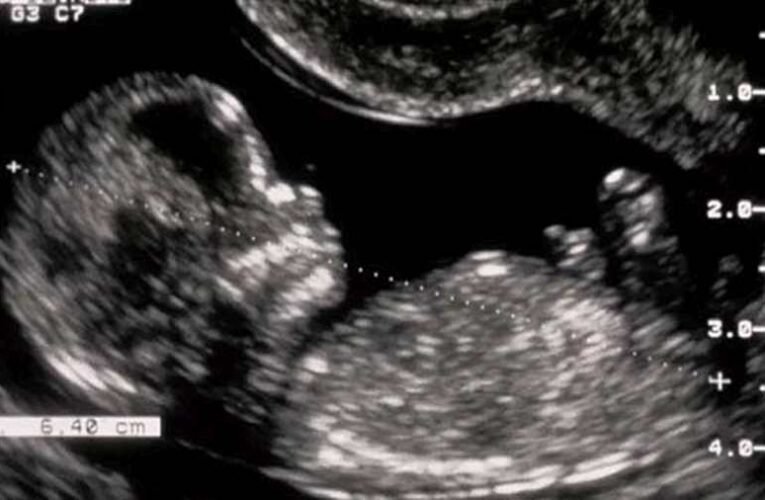 Modern Taigetosz Franciaországban…